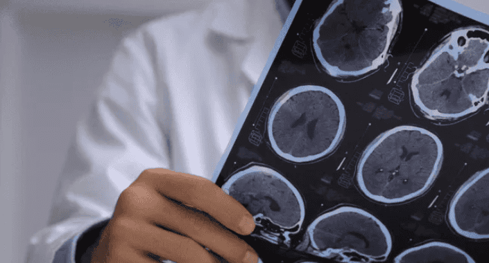 Imágenes de resonancia cerebral en un médico revisando resultados médicos radiológicos de neuroimagen en un hospital peruano.